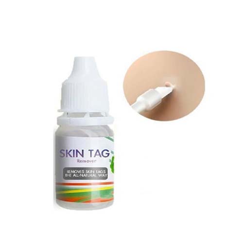 Skin Tags Removal Cream in Pakistan